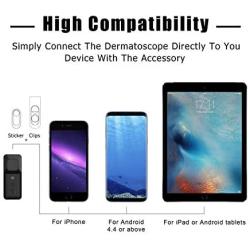 SKIARY Smartphone Dermatoscope ,skin analyzer Microscopy, Dermatologist Clinical Diagnosis Tool with polarized light and UV light, work with iPhone, iPad, Samsung Galaxy, Android phones (Black)