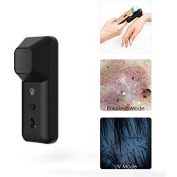 SKIARY Smartphone Dermatoscope ,skin analyzer Microscopy, Dermatologist Clinical Diagnosis Tool with polarized light and UV light, work with iPhone, iPad, Samsung Galaxy, Android phones (Black)