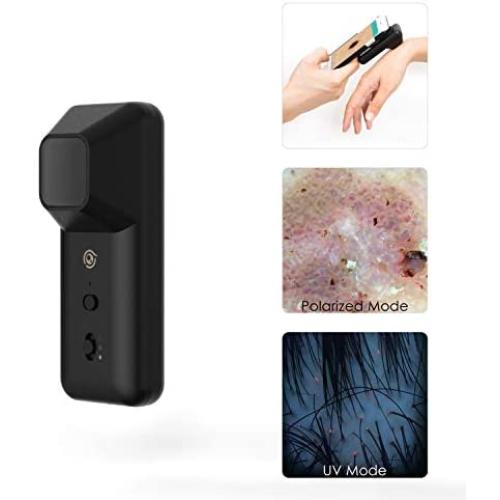 SKIARY Smartphone Dermatoscope ,skin analyzer Microscopy, Dermatologist Clinical Diagnosis Tool with polarized light and UV light, work with iPhone, iPad, Samsung Galaxy, Android phones (Black)