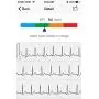 BodiMetrics Performance Monitor