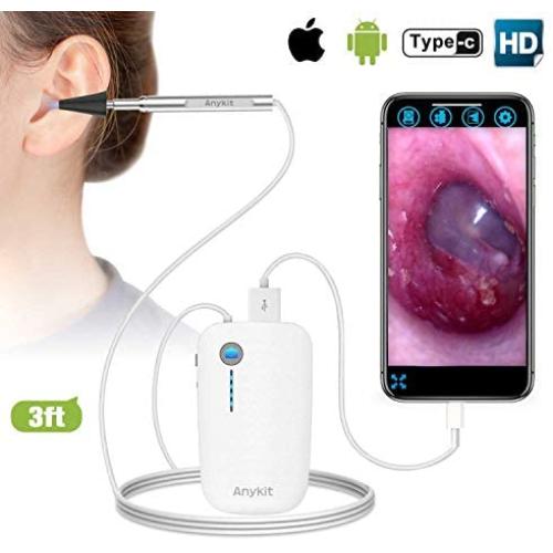 Otoscope iPhone, Anykit Upgraded 4.3mm 720P HD Ear Scope Camera Digital Otoscope with 6 LED Lights, Earwax Removal Tool and Specula for iPhone and Android Smartphone