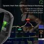 MorePro SPO2 Blood Oxygen Blood Pressure Heart Rate Monitor Waterproof Fitness Tracker Activity Tracker HRV Health Watch with Enhanced Sleep Monitor for Android iOS Women Men