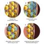 Igia Fat Freezer Platinum Targeted Cold Cryolipolysis System (Standard)
