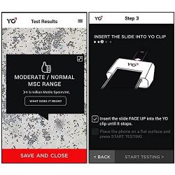YO Home Sperm Test for Apple iPhone | Includes 2 Tests | Mens Motile Sperm Fertility Test | Check Moving Sperm and Record Video | Apple iPhone 7